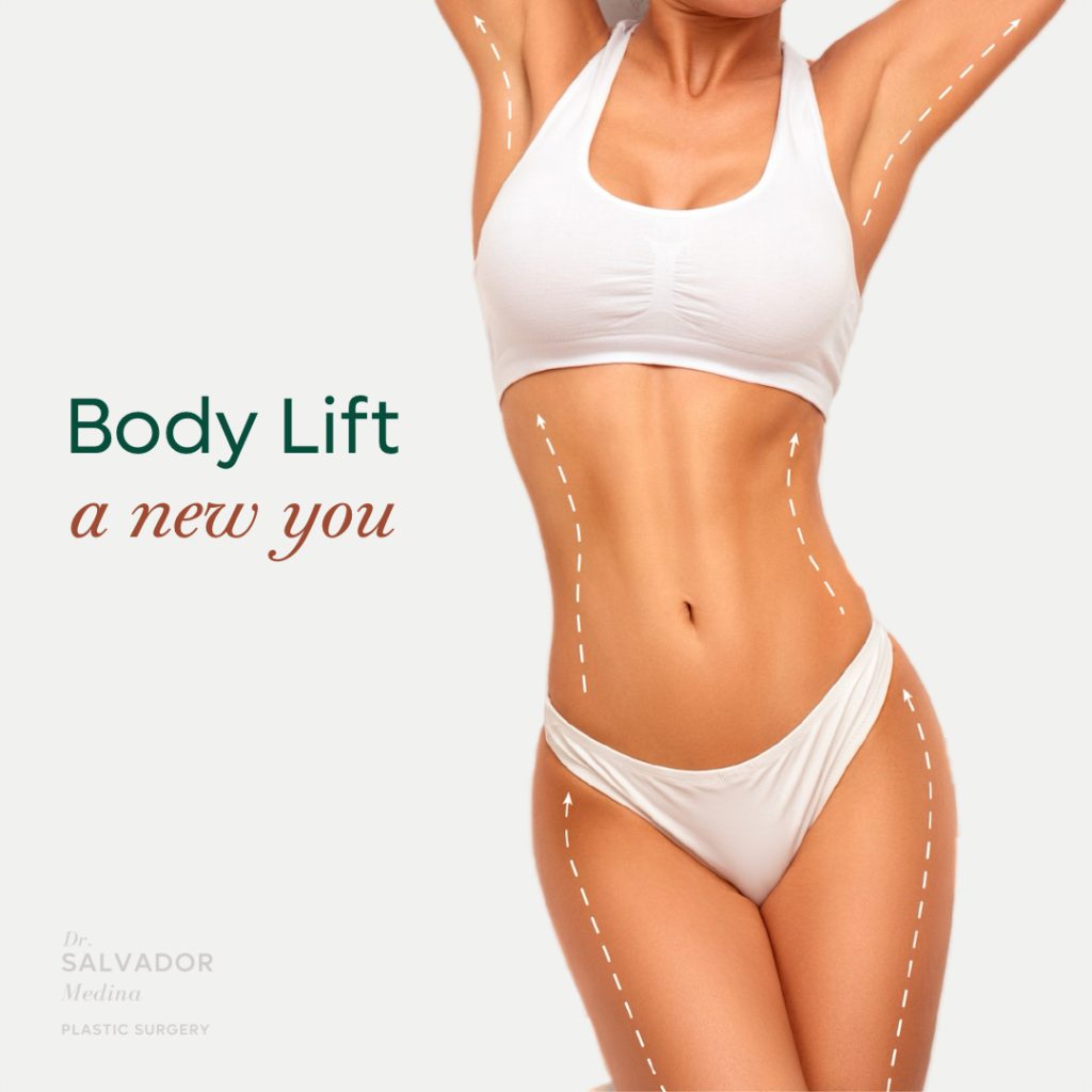 Body Lift