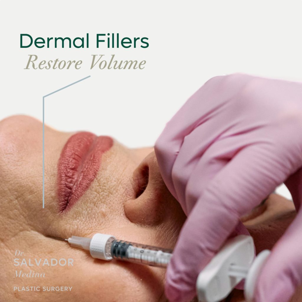 Dermal Filler Procedure