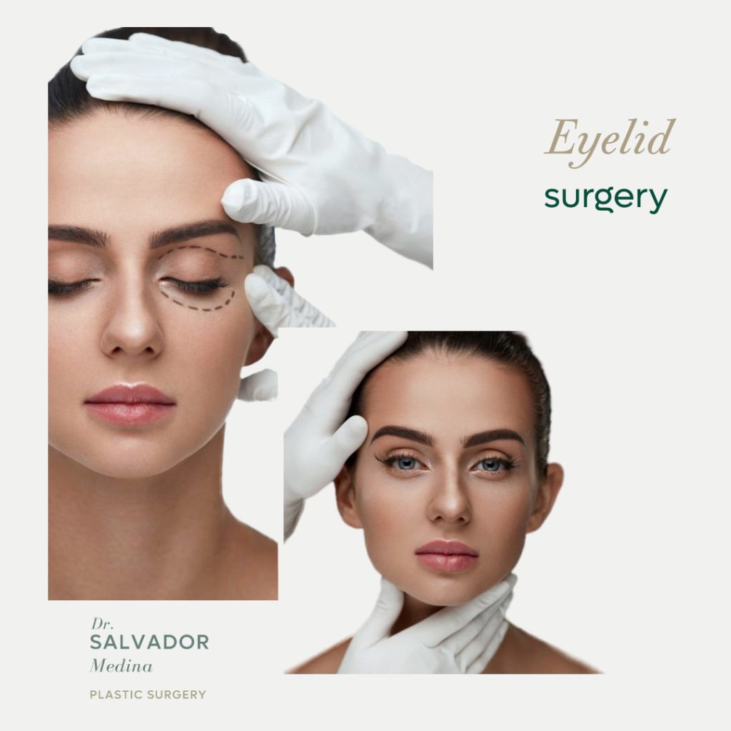 What is Eyelid Surgery?