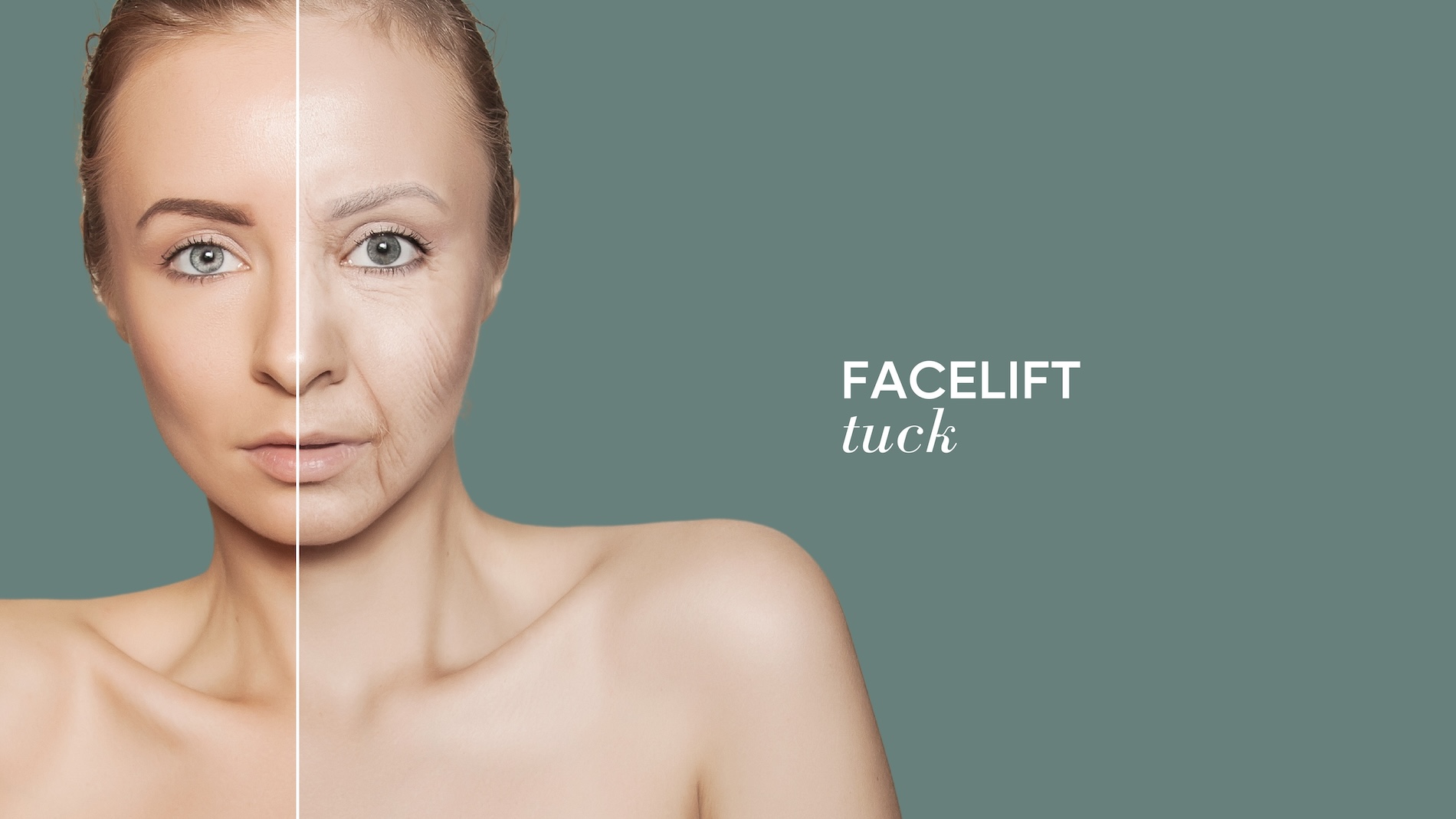 Facelift surgery Tijuana