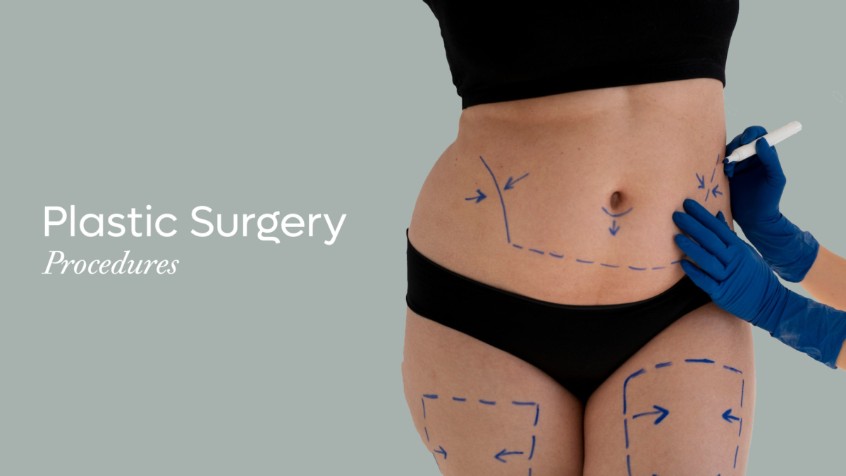 Plastic Surgery Procedures