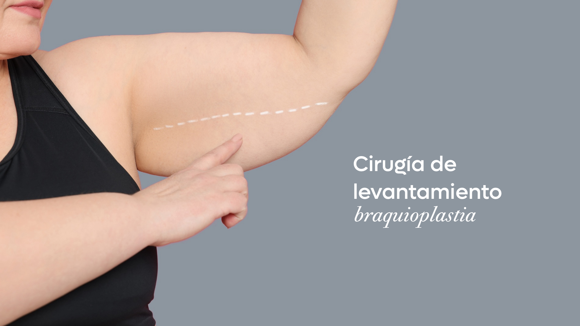 Cirugía de levantamiento de brazos o braquioplastia