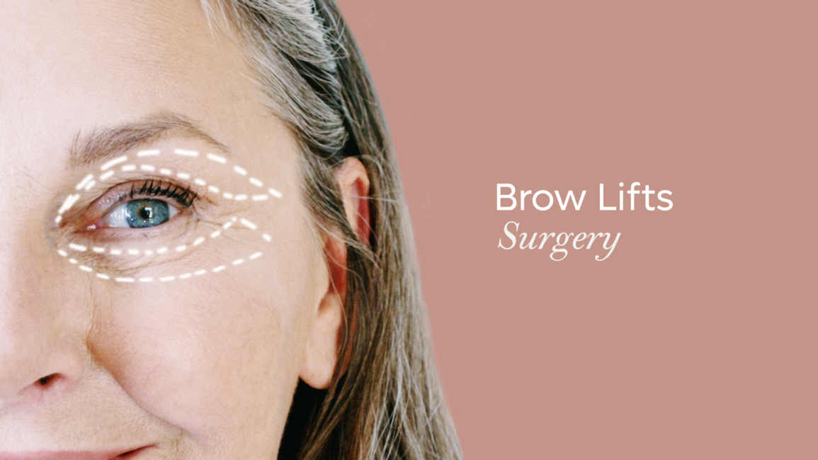 A brow lift, also known as a forehead lift