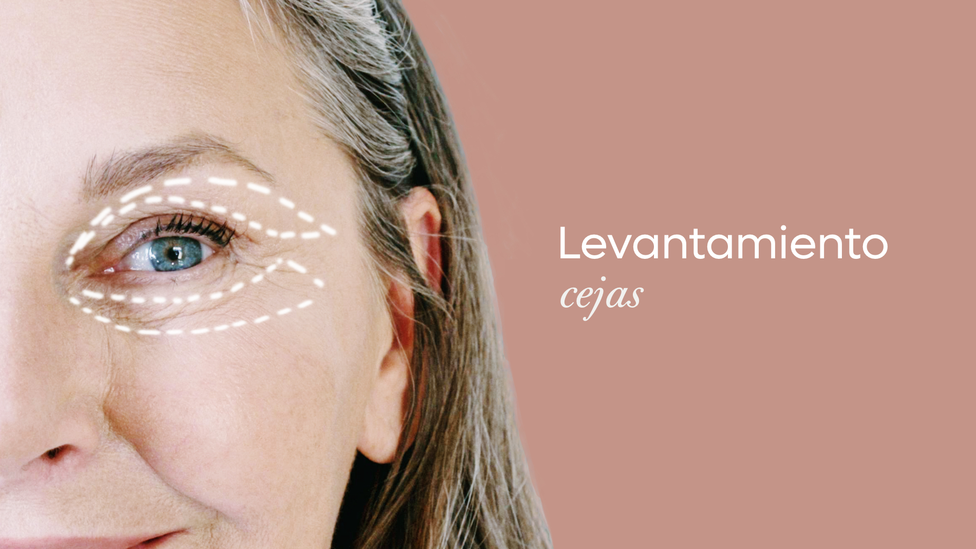 Un levantamiento de cejas, también conocido como levantamiento de frente.