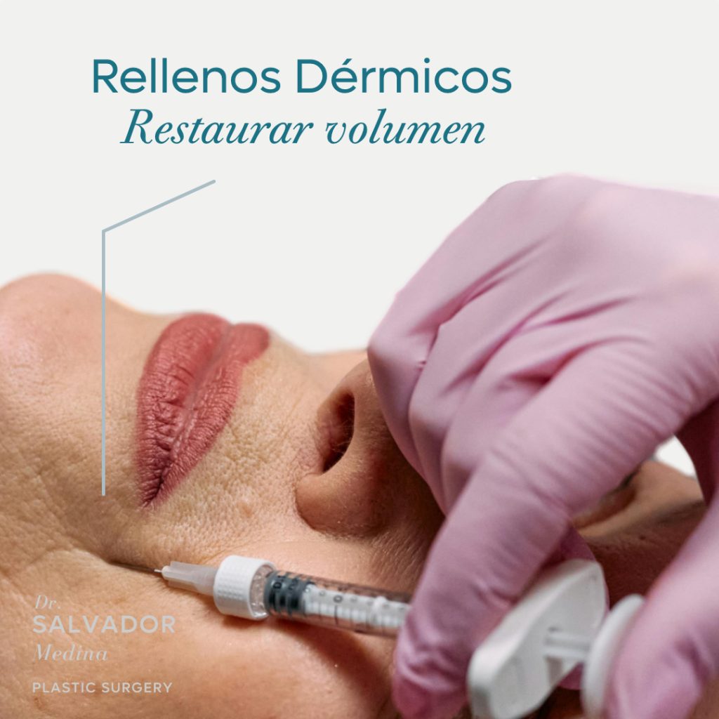 rellenos dérmicos
