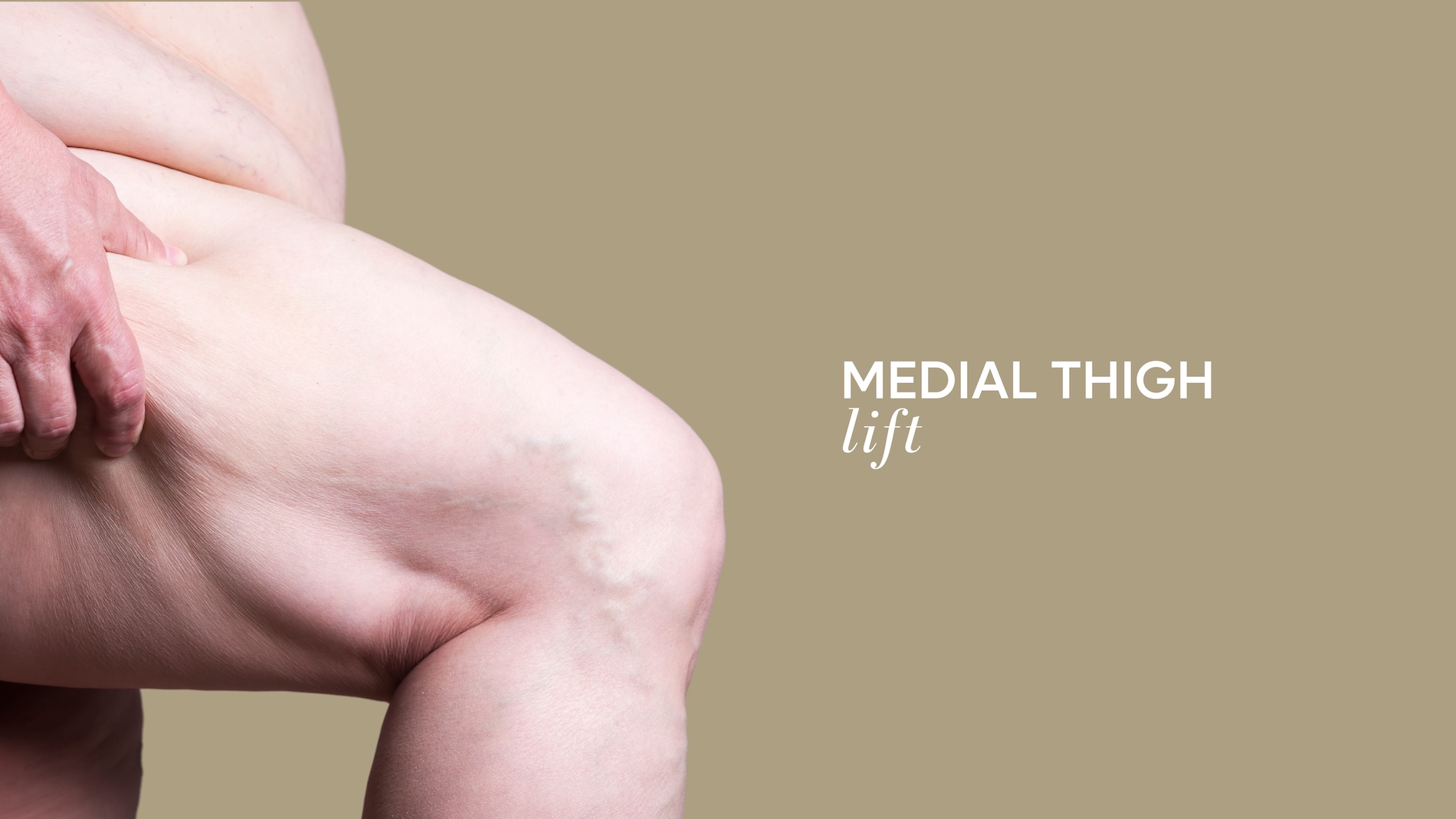 lifting de muslos mediales