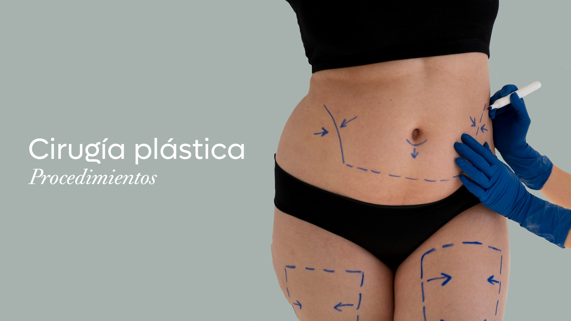 Procedimientos de cirugía plástica