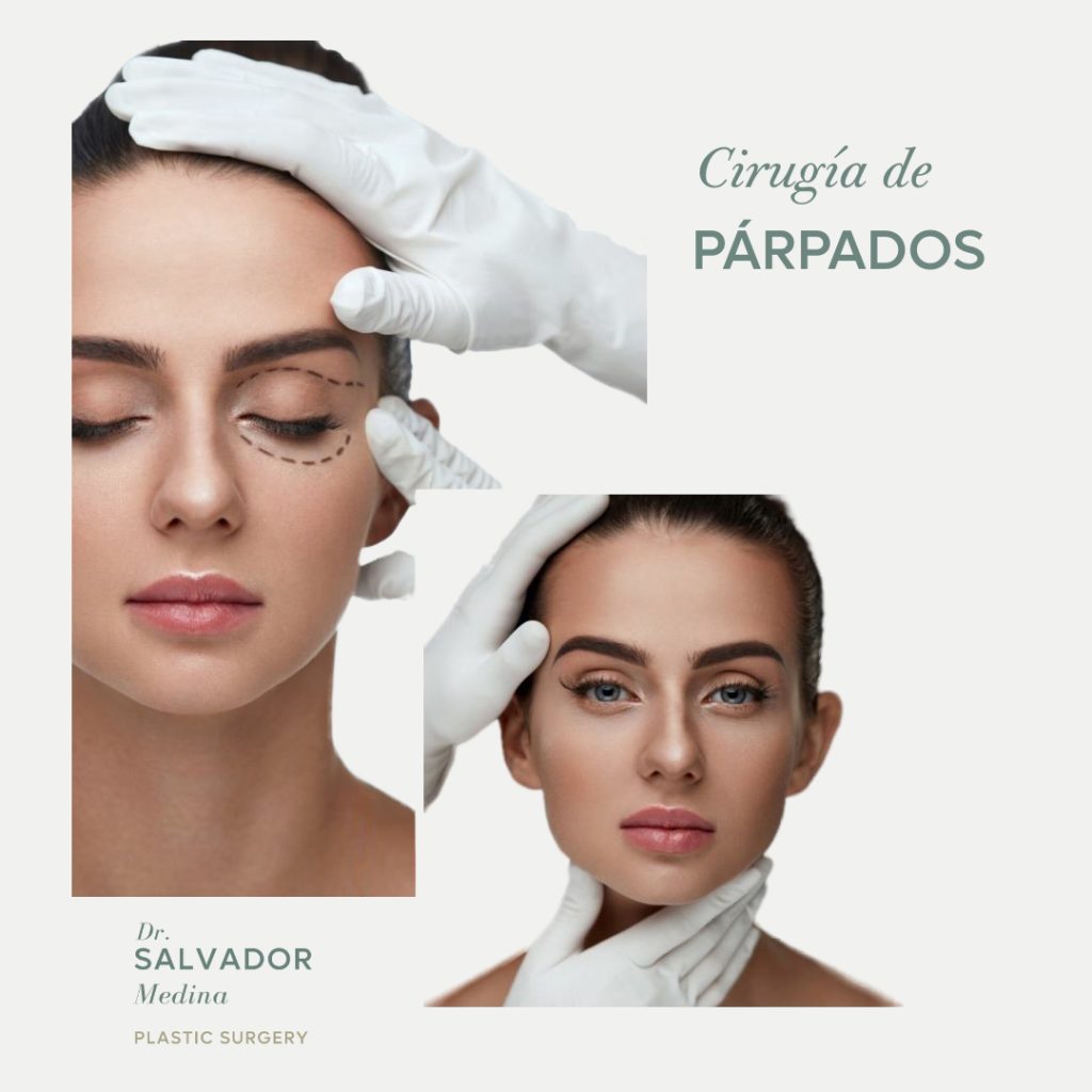 ¿Qué es la cirugía de párpados?