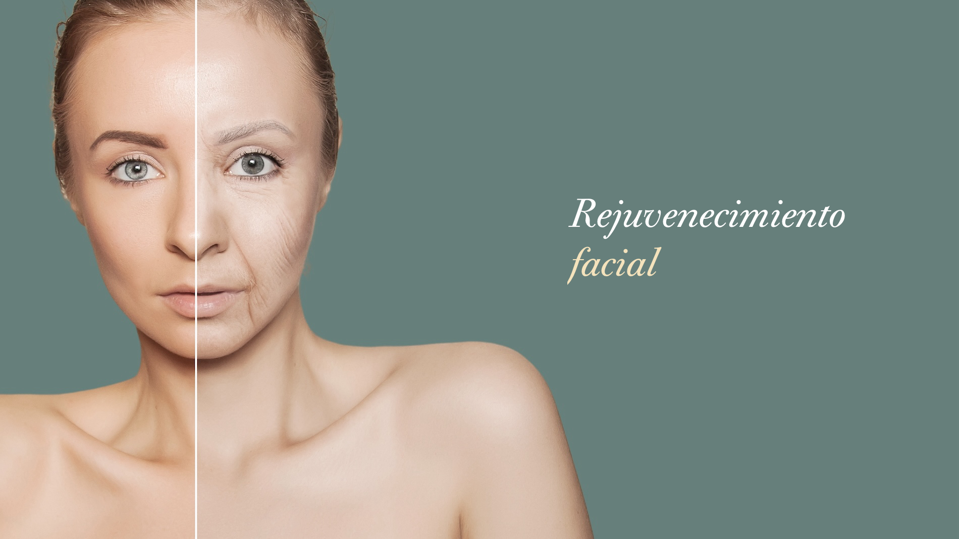 Cirugía de lifting facial Tijuana. Cirugia de Rejuvenecimeinto facial