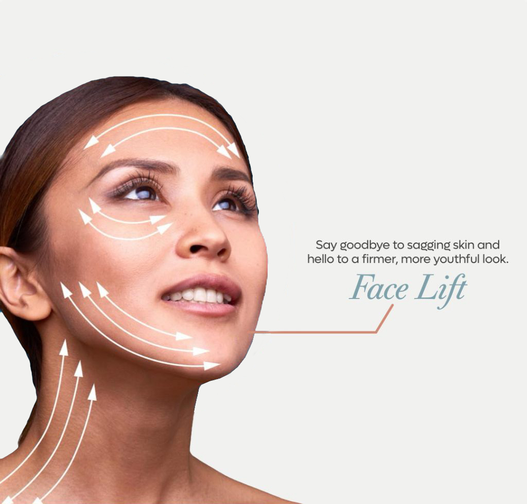 What is Facelift Surgery?