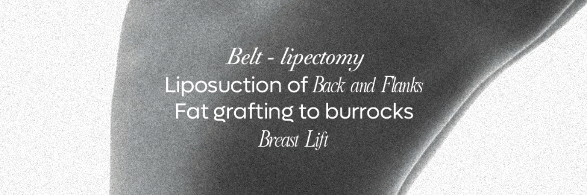 Life-Changing Lower Body Lift in Tijuana / Belt Lipectomy