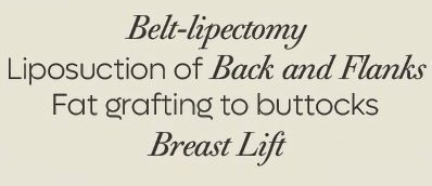 Life-Changing Lower Body Lift in Tijuana / Belt Lipectomy