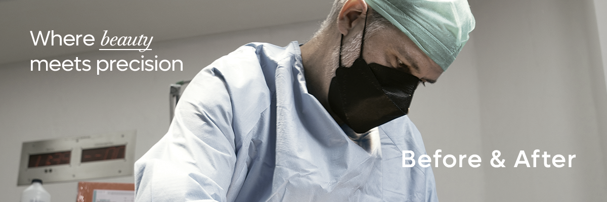 Before and After, Plastic Surgery Procedures with Dr. Salvador medina